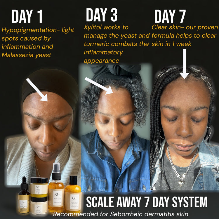 "Before: scaly face patches, After: clear skin using our system"