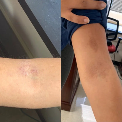 Eczema Relief Kit Go Nude Skincare
anti-inflammatory skincare

hydration restoring skincare

aloe vera skin calming treatment

plant-based skincare for eczema

non-toxic skincare for psoriasis

eczema and psoriasis soothing formula

paraben-free skincare products

nourishing body care for irritation